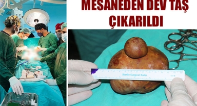 MESANEDEN DEV TAŞ ÇIKARILDI