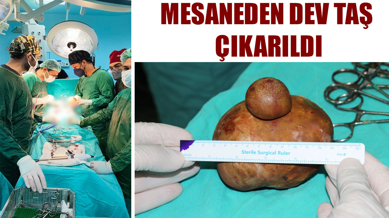 MESANEDEN DEV TAŞ ÇIKARILDI